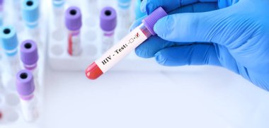 Doctor's hand holds test tube in blood on the background of test tubes with analyzes.Blood sample positive with HIV testing. Banner. Copy space for text