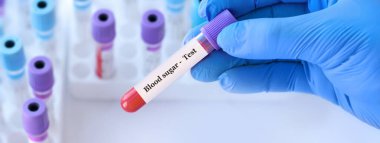Doctor holding a test blood sample tube with Sugar test on the background of medical test tubes with analyzes.Copy space for text