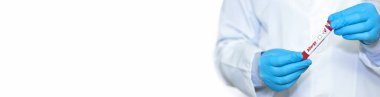 Doctor holding a test blood sample tube with allergy test.Banner. Copy space for text