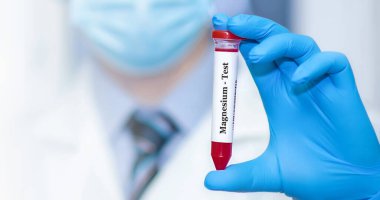 Doctor holding a test blood sample tube with Magnesium test.