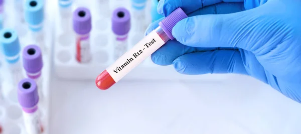 Лікар Тримає Пробну Пробірку Крові Вітаміном В12 Тлі Медичних Пробних — стокове фото