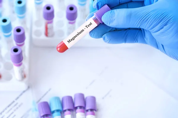 stock image Doctor holding a test blood sample tube with Magnesium test on the background of medical test tubes with analyzes