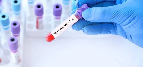 Doctor Holding Test Blood Sample Tube Mycoplasma Test Background Medical — стокове фото