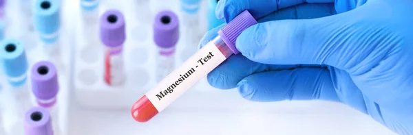 stock image Doctor holding a test blood sample tube with Magnesium test on the background of medical test tubes with analyzes