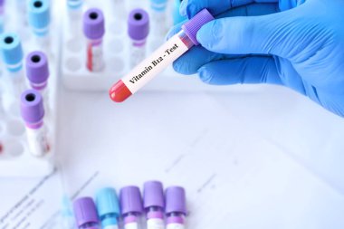 Doctor holding a test blood sample tube with Vitamin B12 test on the background of medical test tubes with analyzes
