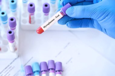 Doctor holding a test blood sample tube with Mycoplasma test on the background of medical test tubes with analyzes.