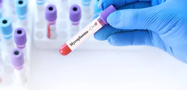 stock image Doctor holding a test blood sample tube positive with Mycoplasma test on the background of medical test tubes with analyzes.Banner.