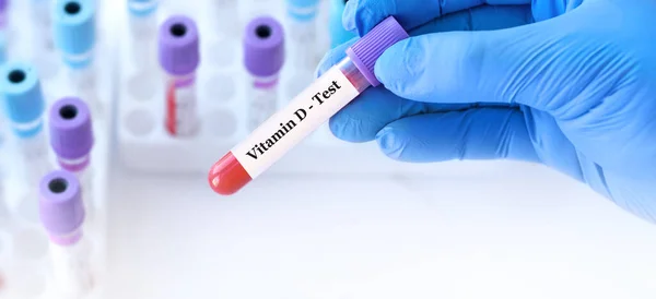 Stock image Doctor holding a test blood sample tube with Vitamin D test on the background of medical test tubes with analyzes