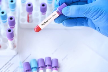 Doktor, tıbbi test tüplerinin arka planında Trigliserit testi olan bir test tüpü tutuyor.
