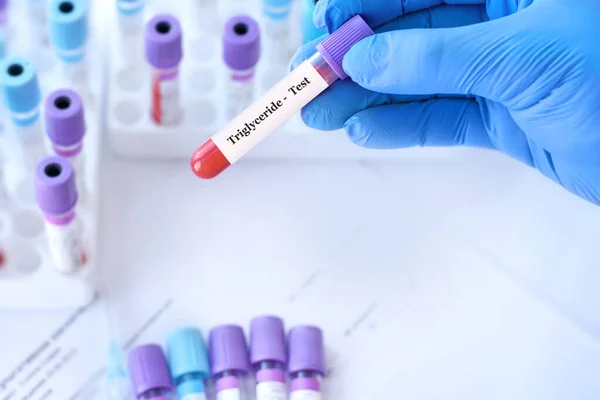 Doktor, tıbbi test tüplerinin arka planında Trigliserit testi olan bir test tüpü tutuyor.