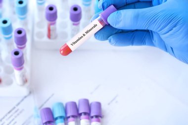 Analiz edilen tıbbi test tüplerinin arka planında vitamin ve mineral testleri olan bir test tüpü tutan doktor.