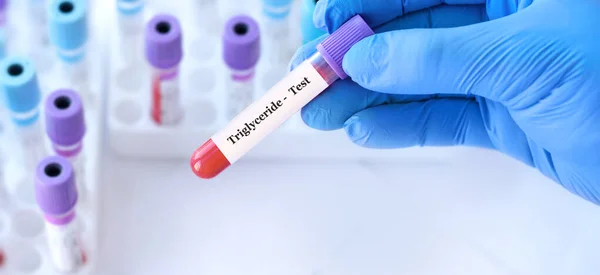 Доктор Тригліцеридний Тест Тлі Медичних Пробних Трубок Аналізами — стокове фото