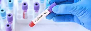 Doktor, tıbbi test tüplerinin arka planında Trigliserit testi olan bir test tüpü tutuyor.