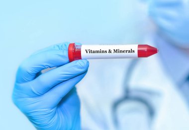 Doktor, elinde vitamin ve mineral testi olan bir tüp kan örneği tutuyor..