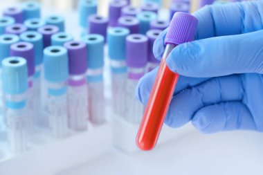 Doktorun eldiveni ile birlikte tıbbi test tüplerinin arka planında kan örneği olan bir test tüpü bulunduruyor..