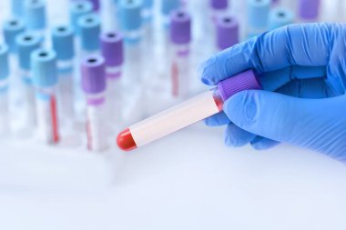 Hand with medical glove of doctor holds test tube with blood sample and blank label for own text on the background of medical test tubes.