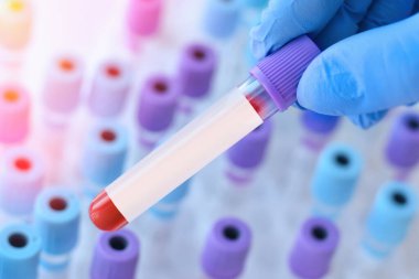 Hand with medical glove of doctor holds test tube with blood sample and blank label for own text on the background of medical test tubes.