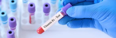 Doktor, tıbbi test tüplerinin arka planında B-1 vitamini testi olan bir test tüpü tutuyor..