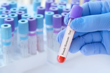 Doktor, tıbbi test tüplerinin arka planında kadın hormon testi olan bir test tüpü tutuyor. Metin için alanı kopyala..