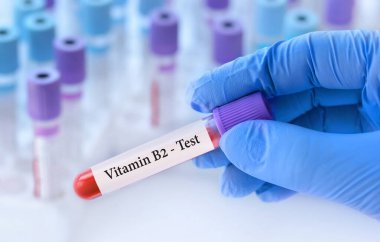 Analizli tıbbi test tüplerinin arka planında B2 vitamini testi olan bir test tüpü tutan doktor.