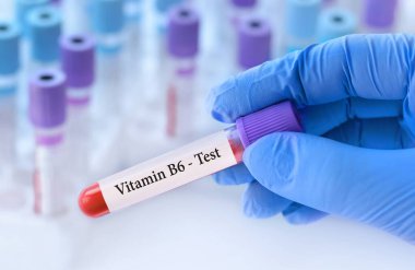 Doktor, tıbbi test tüplerinin arka planında B-6 vitamini içeren bir test tüpü tutuyor..