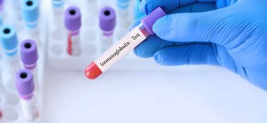 Doktor, tıbbi test tüplerinin arka planında immünoglobulin testi olan bir test tüpü tutuyor.