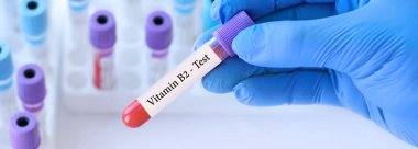 Analizli tıbbi test tüplerinin arka planında B2 vitamini testi olan bir test tüpü tutan doktor. Pankart