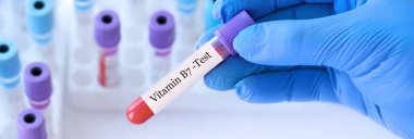Analizli tıbbi test tüplerinin arka planında B-7 vitamini testi olan bir test tüpü tutan doktor.