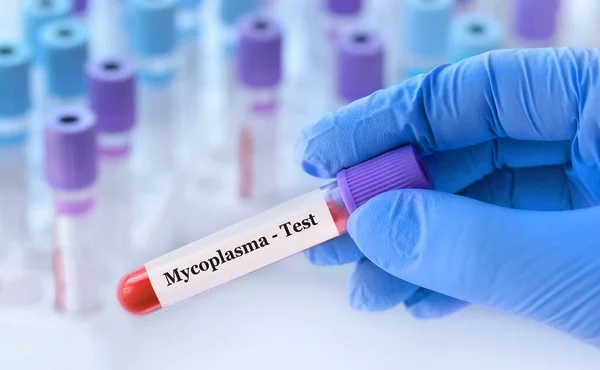 stock image Doctor holding a test blood sample tube with Mycoplasma test on the background of medical test tubes with analyzes.