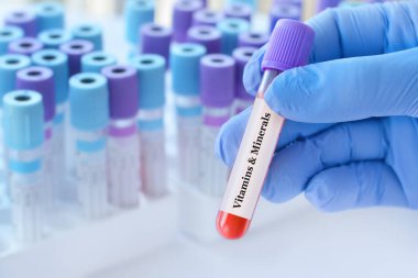 Analiz edilen tıbbi test tüplerinin arka planında vitamin ve mineral testleri olan bir test tüpü tutan doktor..