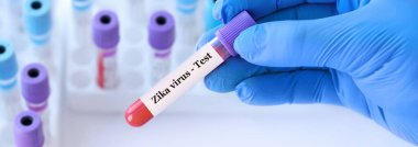 Analizli tıbbi test tüplerinin arka planında Zika virüsü testi olan bir test tüpü tutan doktor. Pankart.