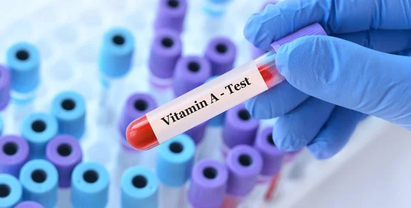 stock image Doctor holding a test blood sample tube with Vitamin A test on the background of medical test tubes with analyzes.Banner. Copy space for text