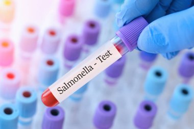 Analizli tıbbi test tüplerinin arka planında Salmonella testi olan bir test tüpü tutan doktor..