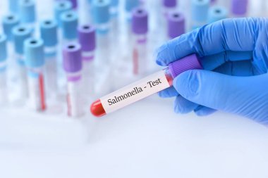 Analizli tıbbi test tüplerinin arka planında Salmonella testi olan bir test tüpü tutan doktor..