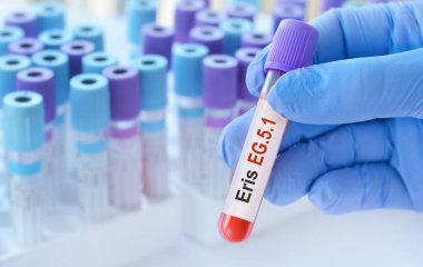 Doktor, tıbbi test tüplerinin arka planında yeni Omicron varyantı Eris EG5.1 'in tespiti için bir test kan tüpü tutuyor..