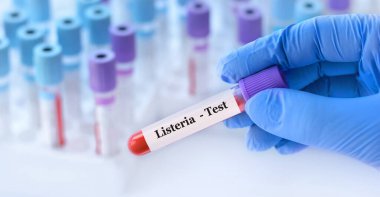Doctor holding a test blood sample tube with Listeria bacteria test on the background of medical test tubes with analyzes clipart