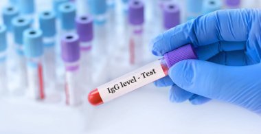 Analizli tıbbi test tüplerinin arka planında IgG seviyesinde bir test tüpü tutan bir doktor.