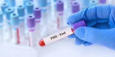 Analizli tıbbi test tüplerinin arka planında hormon (FSH) testi olan bir test tüpü tutan doktor.