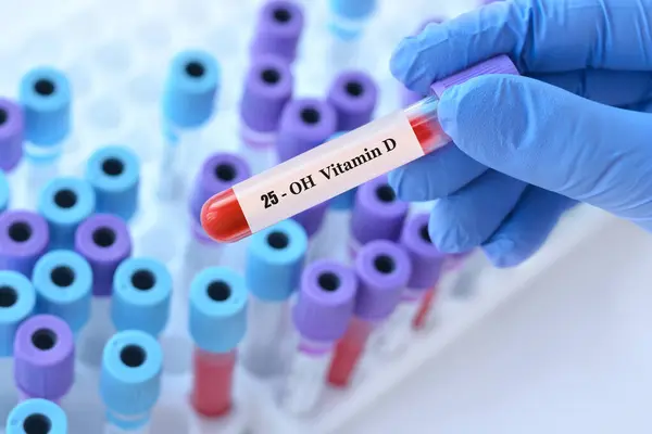 stock image Doctor holding a test blood sample tube with 25 (OH) vitamin D test on the background of medical test tubes with analyzes