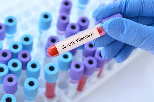 Γιατρός Που Κατέχει Δοκιμαστικό Σωλήνα Δείγματος Αίματος Δοκιμή Βιταμίνης Στο Royalty Free Φωτογραφίες Αρχείου