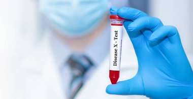 Doktor elinde X hastalığı olan bir test tüpü tutuyor. Dünya koronavirüs salgınından çok daha fazla ölüme yol açabilecek yeni bir salgın hastalığa hazırlanıyor.