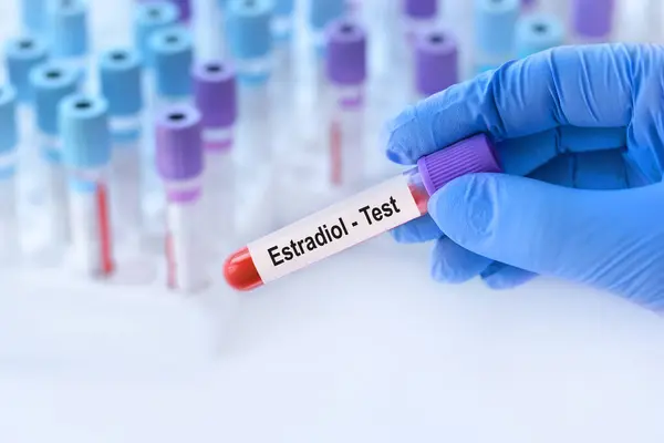 stock image Doctor holding a test blood sample tube with Estradiol test on the background of medical test tubes with analyzes.