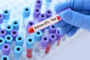 Doktor, tıbbi test tüplerinin arka planında Estrone E1 testi olan bir test tüpü tutuyor..