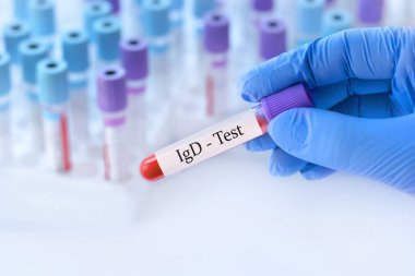 Analizli tıbbi test tüplerinin arka planında IgD (immünoglobulin D) olan bir test tüpü tutan doktor..