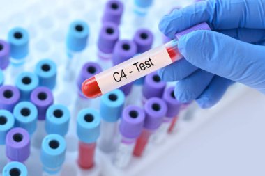 Analizli tıbbi test tüplerinin arka planında C4 testi olan bir test tüpü tutan doktor..
