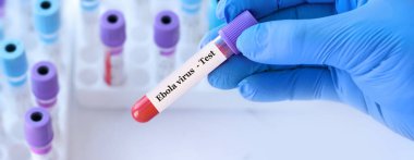 Analizli tıbbi test tüplerinin arka planında Ebola virüsü testi olan bir test tüpü tutan doktor..