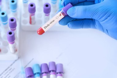 Analizli tıbbi test tüplerinin arka planında Ebola virüsü testi olan bir test tüpü tutan doktor..