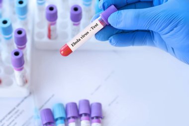 Analizli tıbbi test tüplerinin arka planında Ebola virüsü testi olan bir test tüpü tutan doktor..