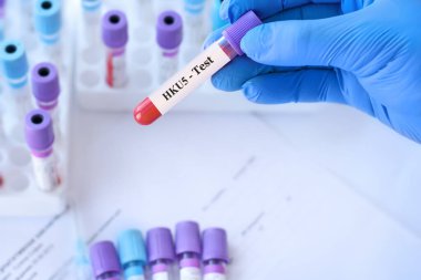 HKU5-CoV-2 virüsü için kan testi tüpü tutan doktor, yarasa koronavirüs tespiti, potansiyel insan enfeksiyonu riski, tıbbi laboratuvar analizi, ortaya çıkan zoonotik hastalık, bilimsel araştırma