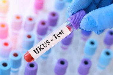 HKU5-CoV-2 kan testi: Örnek tüplü doktor, yarasa koronavirüsü kaynaklı potansiyel insan tehdidi. COVID-19 'a benzer bir ileti.